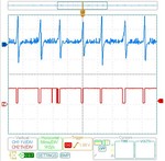 7-27-10 raw vr vs lm1815 output NOISE
